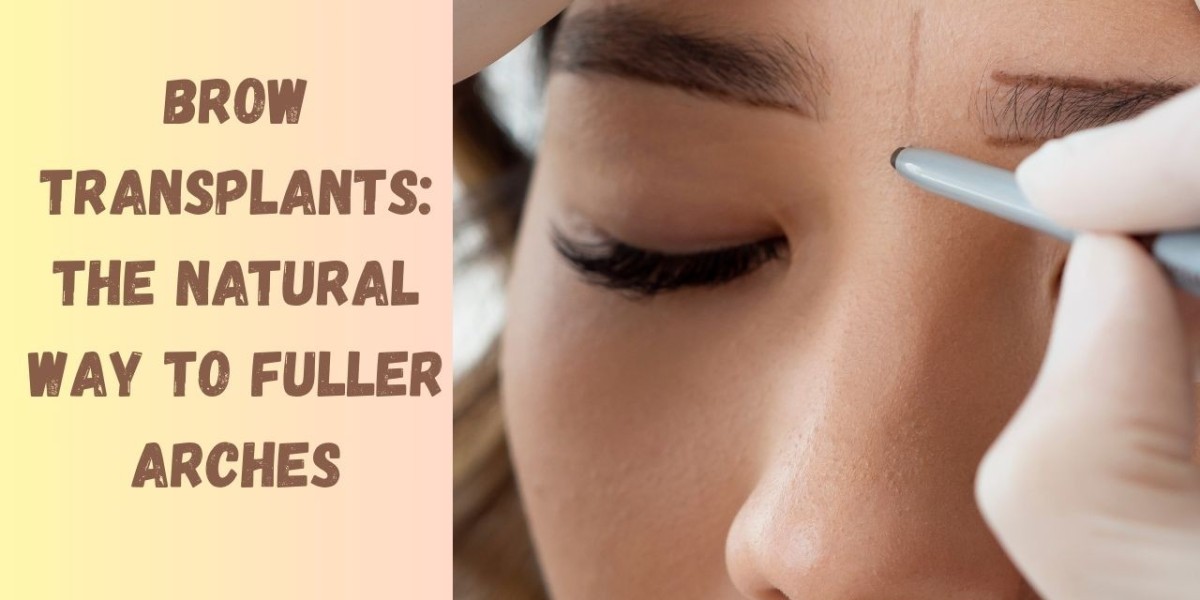 Brow Transplants: The Natural Way to Fuller Arches