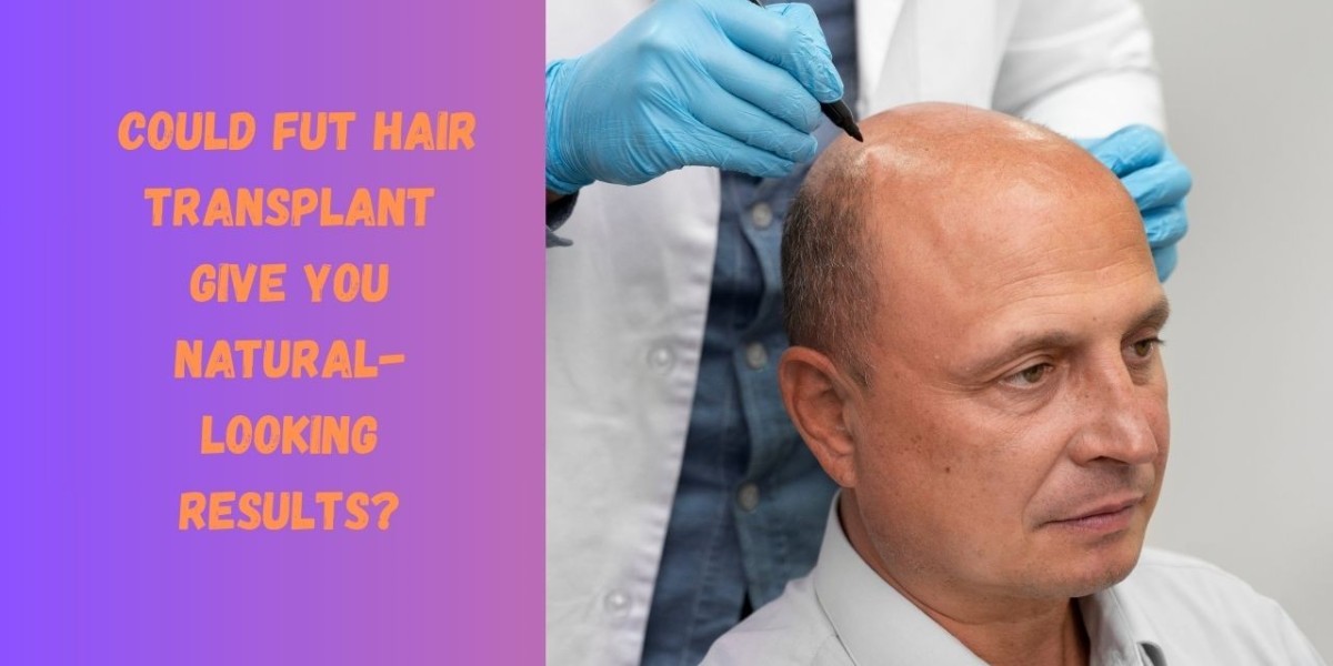 Could FUT Hair Transplant Give You Natural-Looking Results?