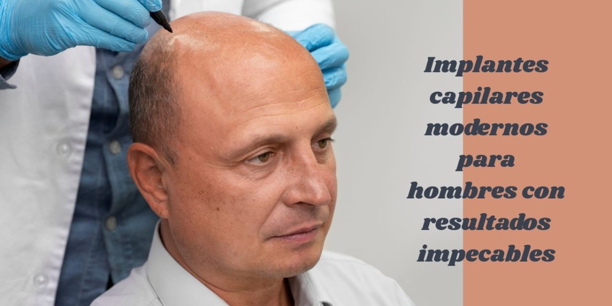 Implantes capilares modernos para hombres con resultados impecables