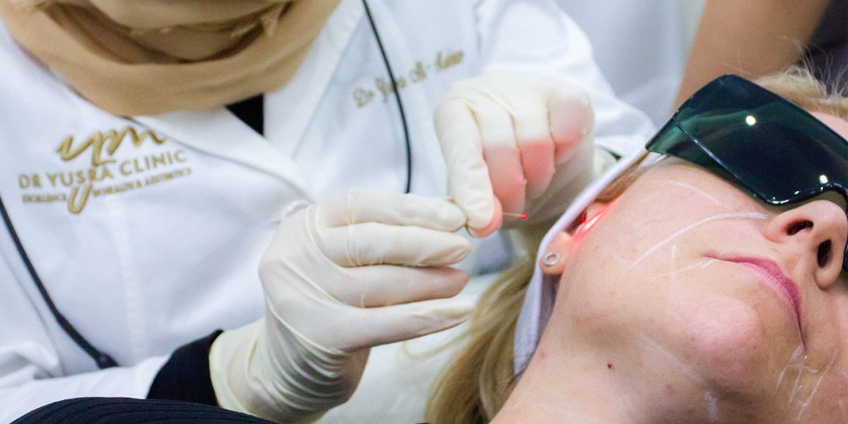 What to Expect Before and After Your Endolift Treatment