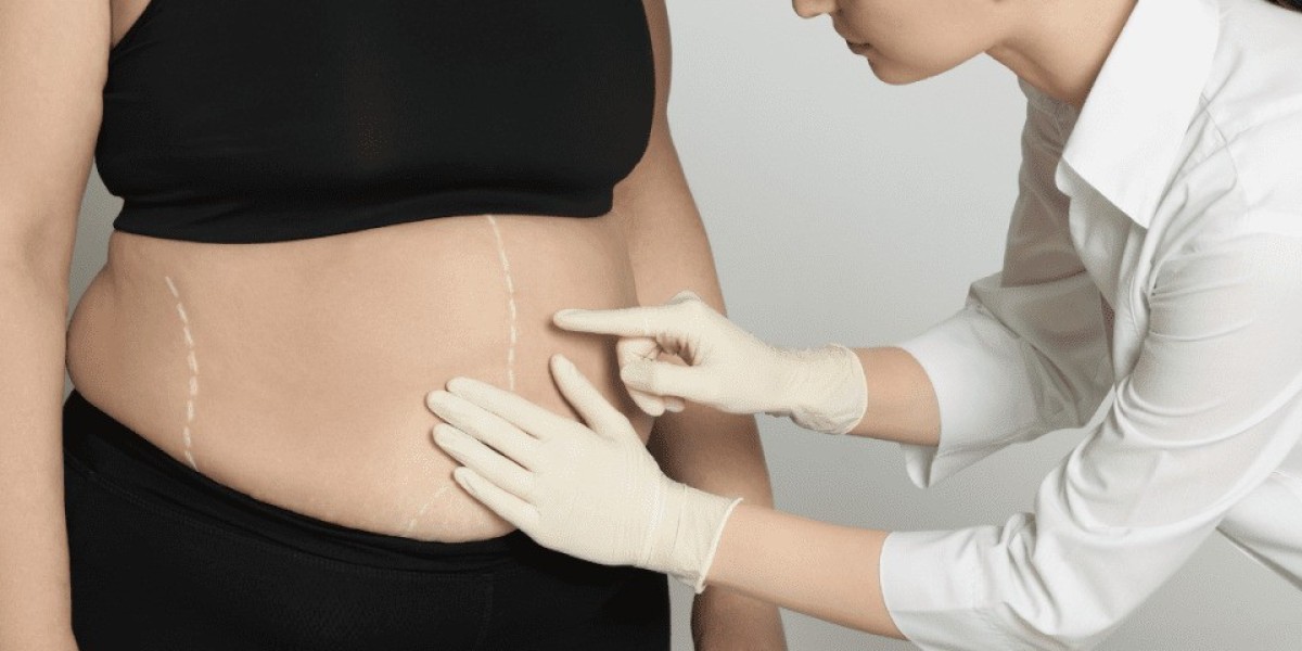 Adjusting to Your New Body After Bariatric Surgery