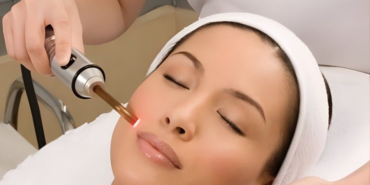 How Chemical Peel Treatment in Islamabad Brightens Skin